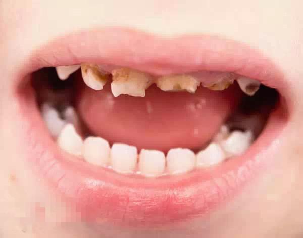 换牙可以吃瓜了,美味瓜果助力健康成长